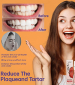 Refreshing Cool Fresh Mint Dry Mouth Spray - Image 2